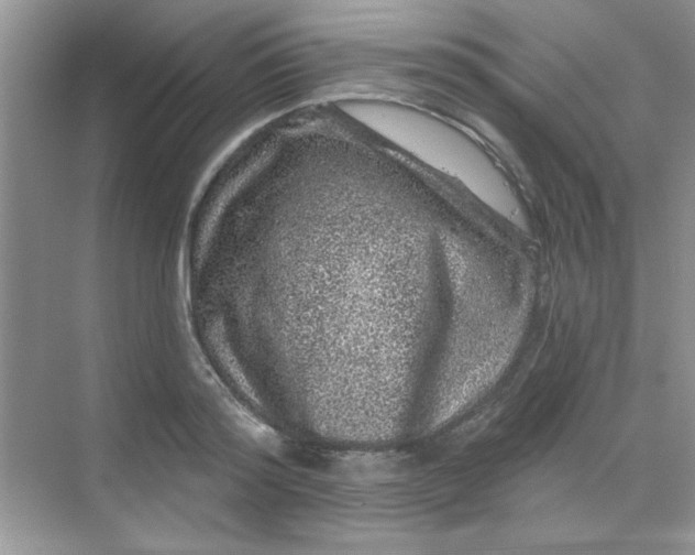 X0000068720796200605121451