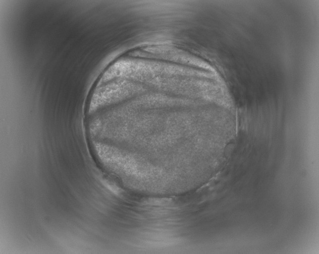 X0000068720147200605192302