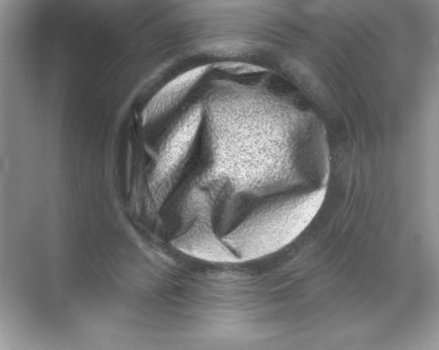 X0000068720400200605192258