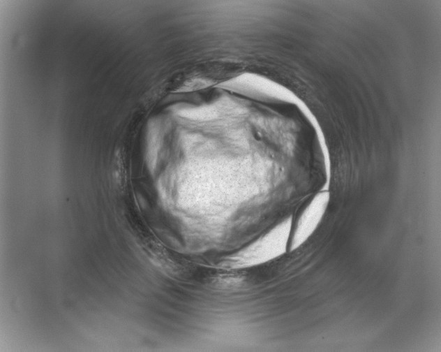 X0000068720651200605192254