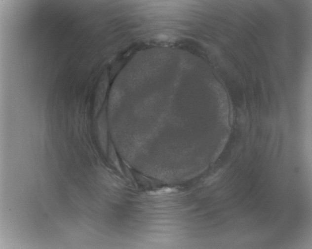 X0000068720818200605192251