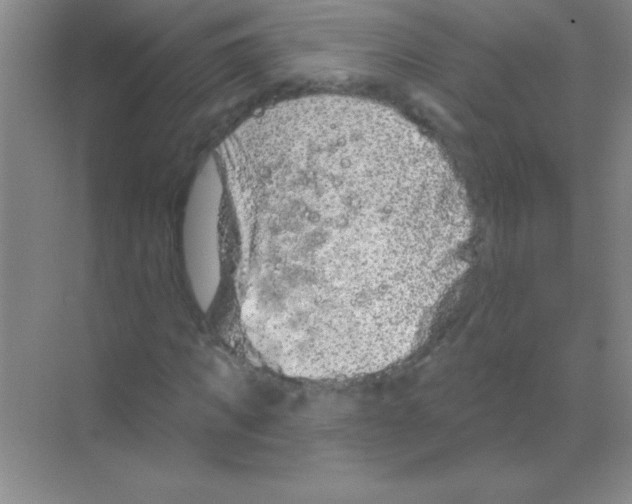 X0000068720917200605192249