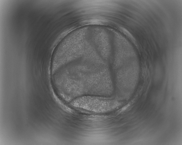 X0000068720938200605192249