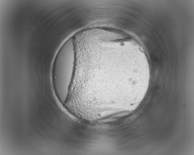 X0000068720957200605192250