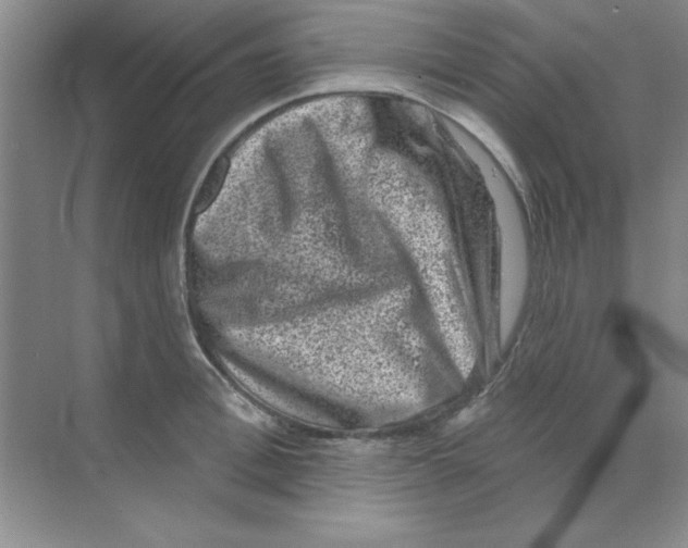 X0000068720996200605192248