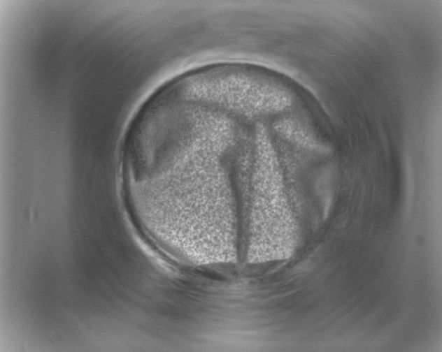 X0000068721511200605192240