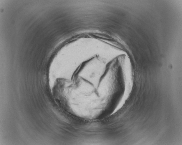 X0000068720063200605262011