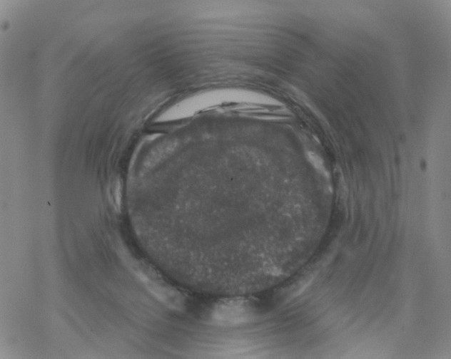 X0000068720076200605262011