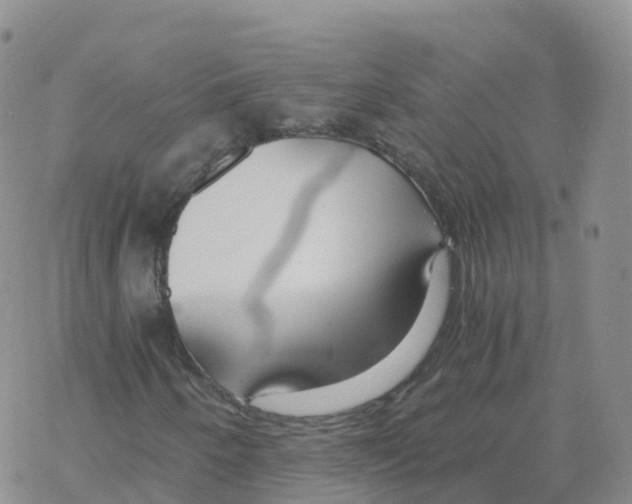 X0000068731250200605262017