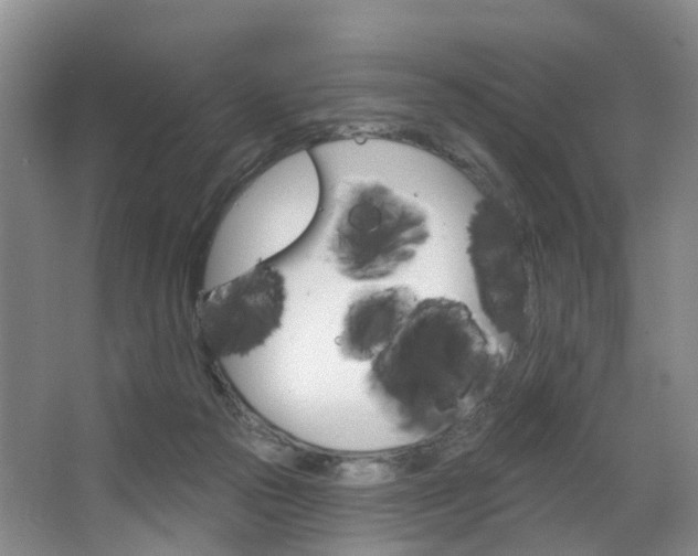 X0000068740169200604281025