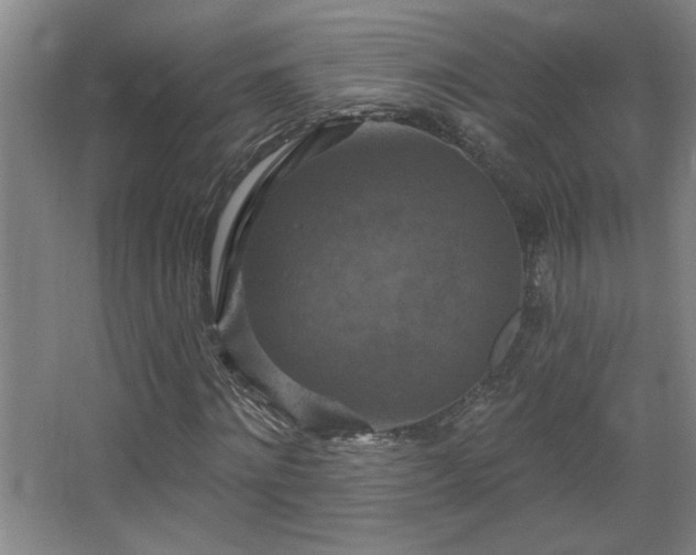 X0000068740868200604281137