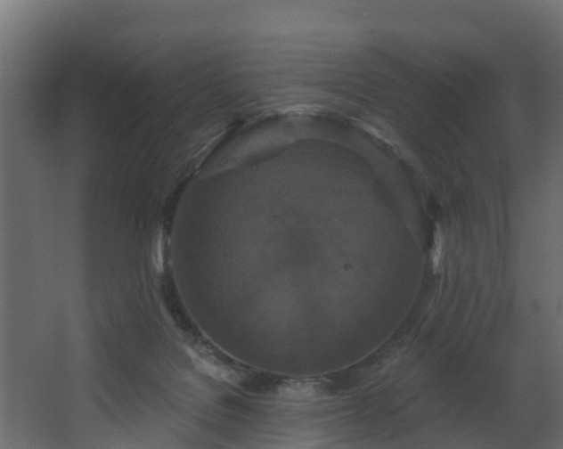 X0000068740076200605011036