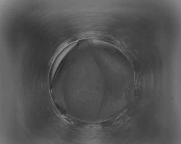 X0000068740099200605011036