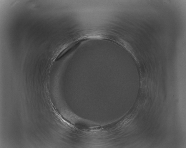 X0000068740385200605011031