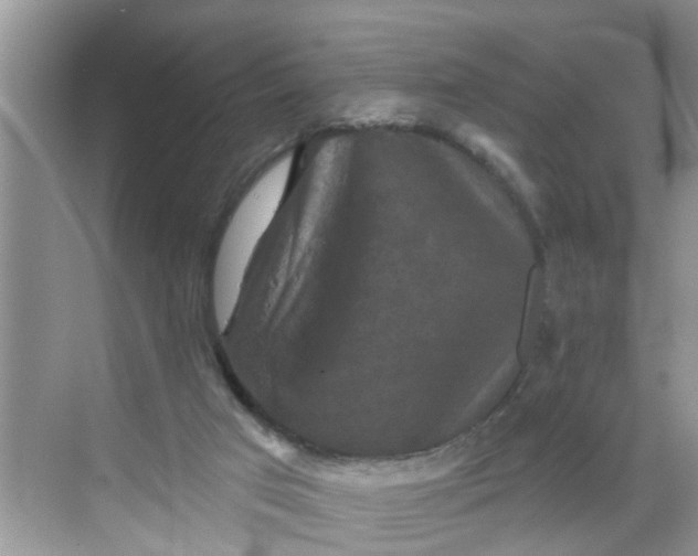 X0000068740017200605121556