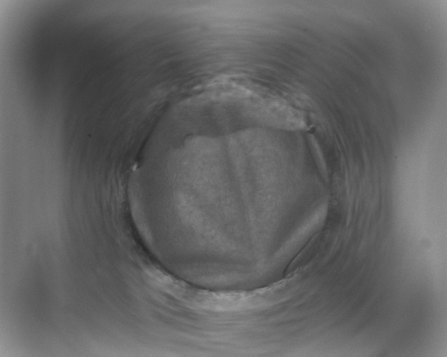 X0000068740037200605121555