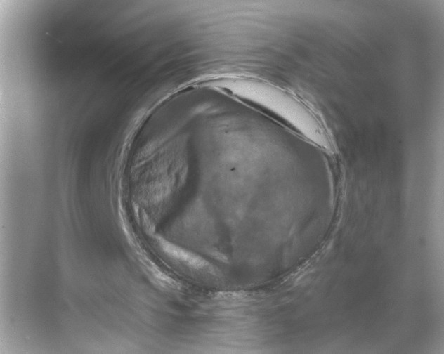 X0000068740145200605121553