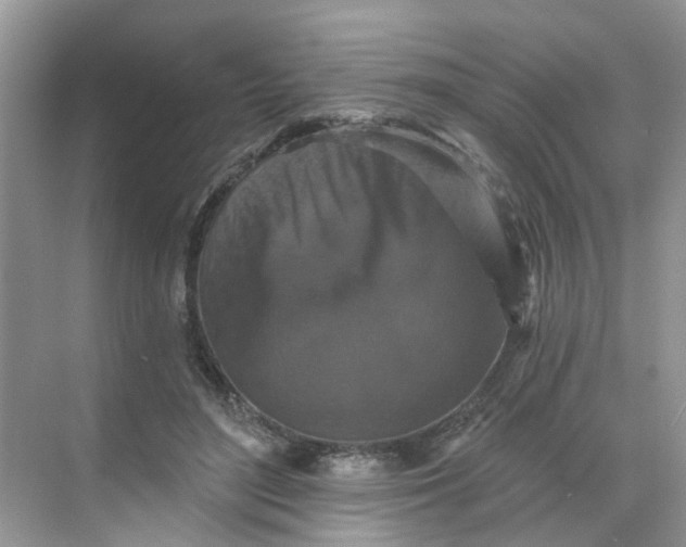 X0000068740500200605121547