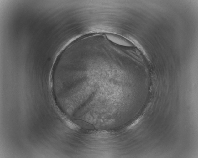 X0000068740885200605121541