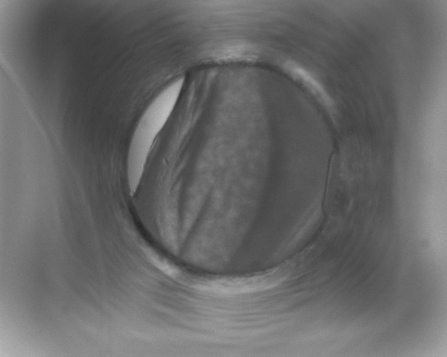 X0000068740017200605192357