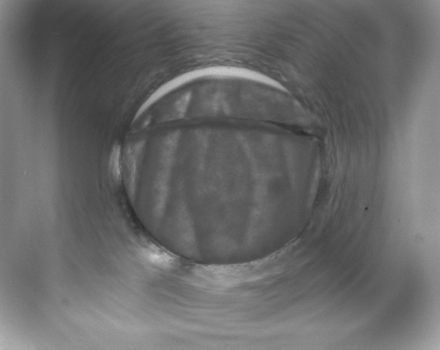 X0000068740041200605192356