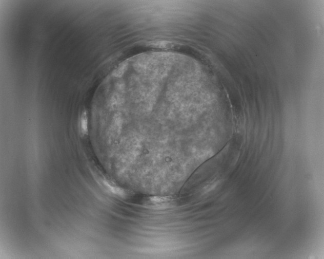 X0000068740095200605192356