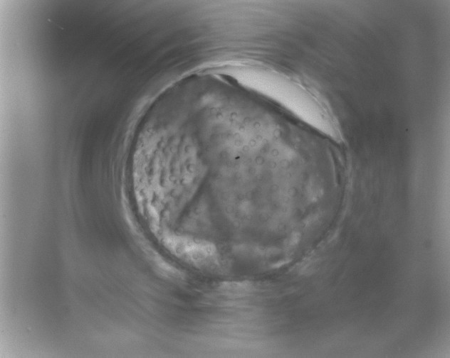 X0000068740145200605192354