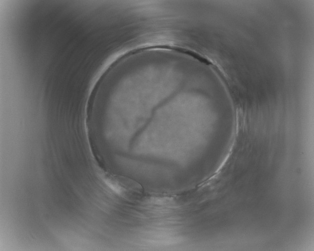 X0000068740147200605192354