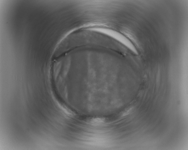 X0000068740156200605192354