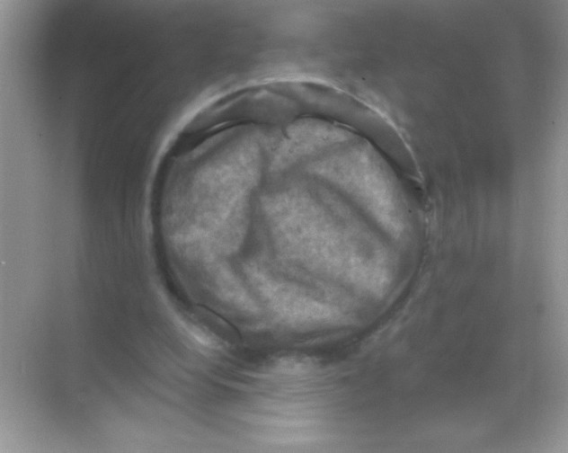 X0000068740248200605192352