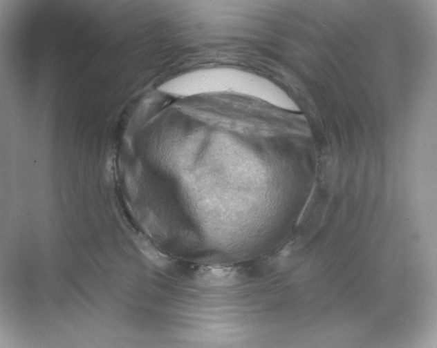 X0000068740329200605192351