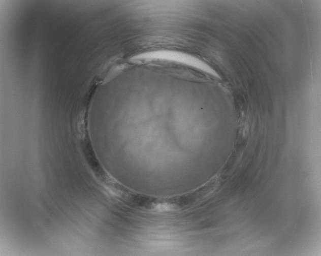 X0000068740360200605192351