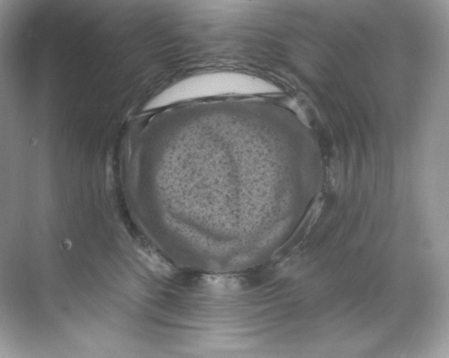 X0000068740520200605192348