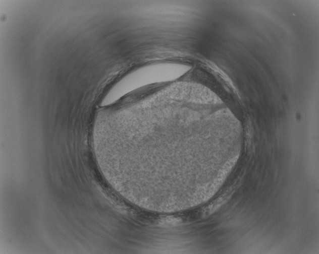 X0000068740257200605262058