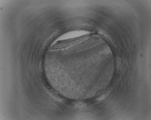 X0000068740258200605262058