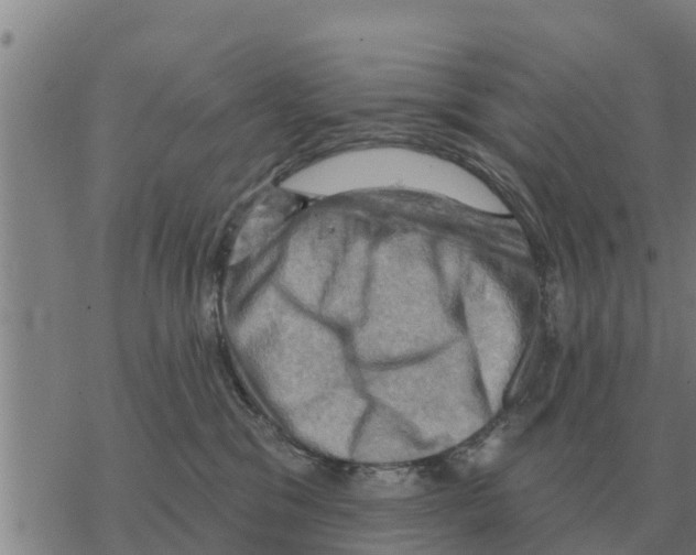 X0000068740329200605262057