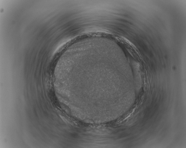 X0000068740775200605262050