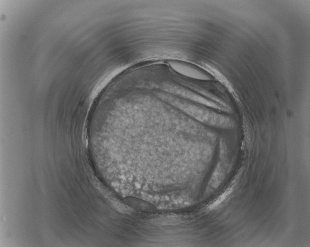 X0000068740885200605262048