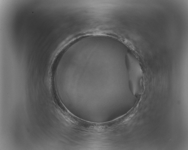 X0000068750295200605121617