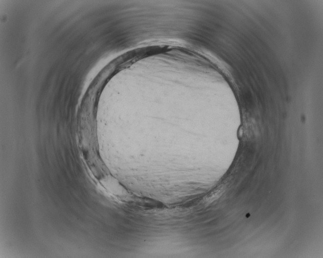 X0000068751102200605191552