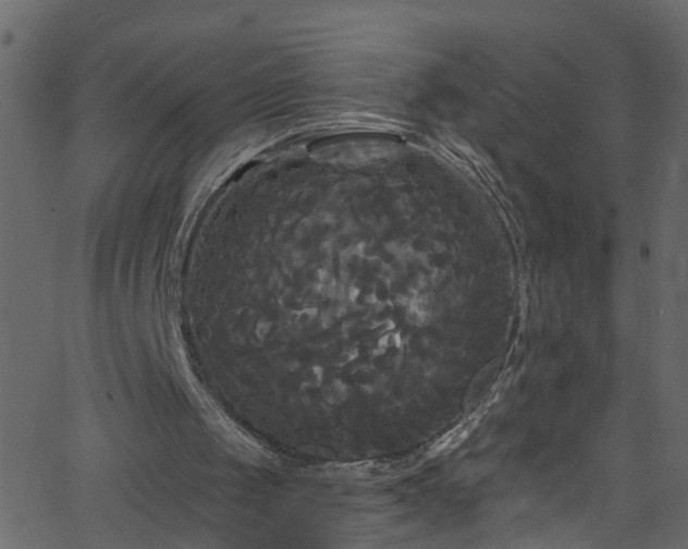 X0000068770049200605011037