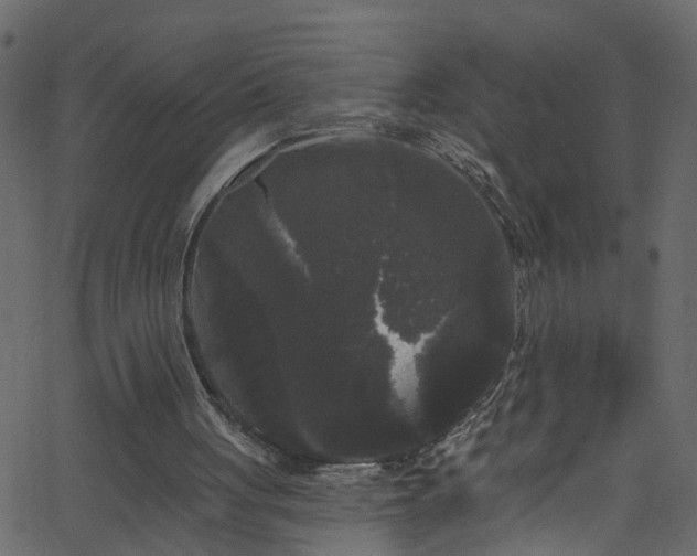 X0000068770051200605011037