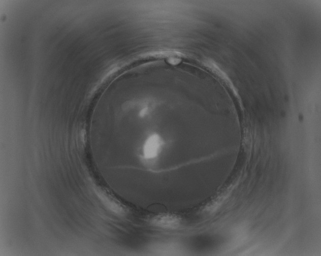 X0000068770063200605011037