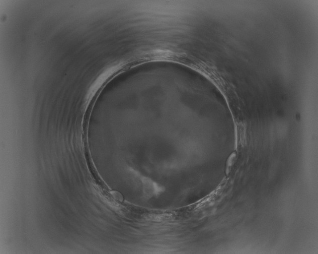 X0000068770147200605011036