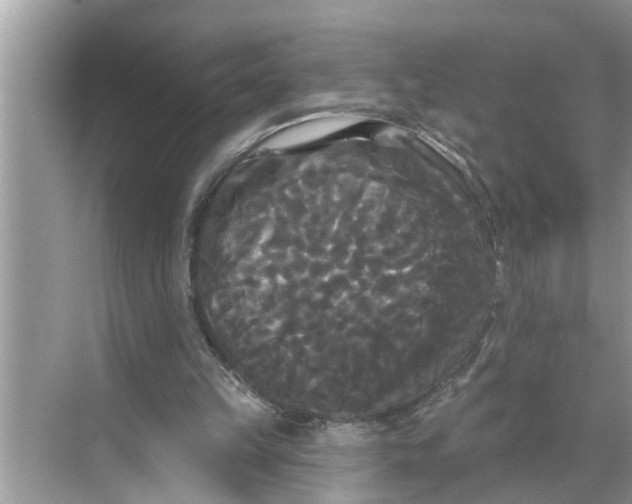 X0000068770149200605121710