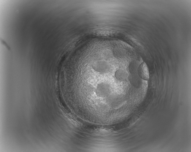 X0000068770737200605121701