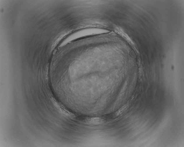 X0000068770058200605191658