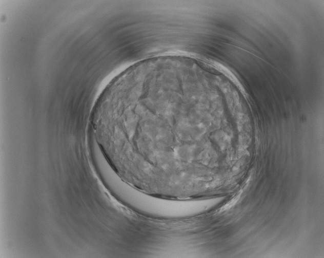 X0000068771149200605262200