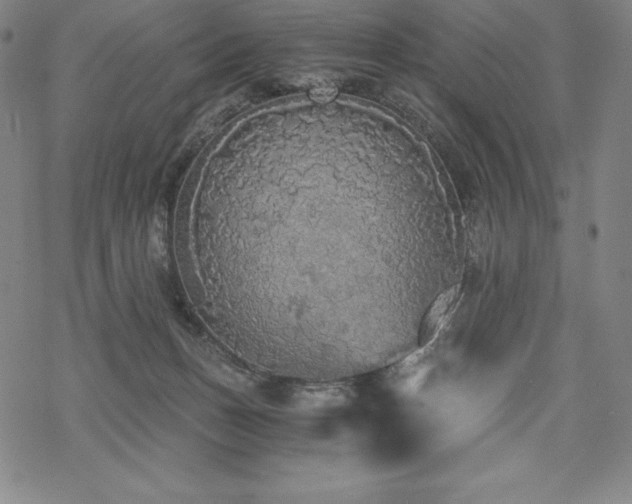 X0000068810175200605051154