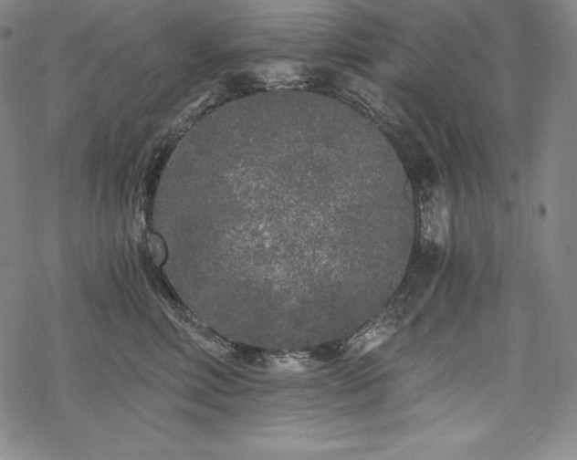 X0000068810618200605051147